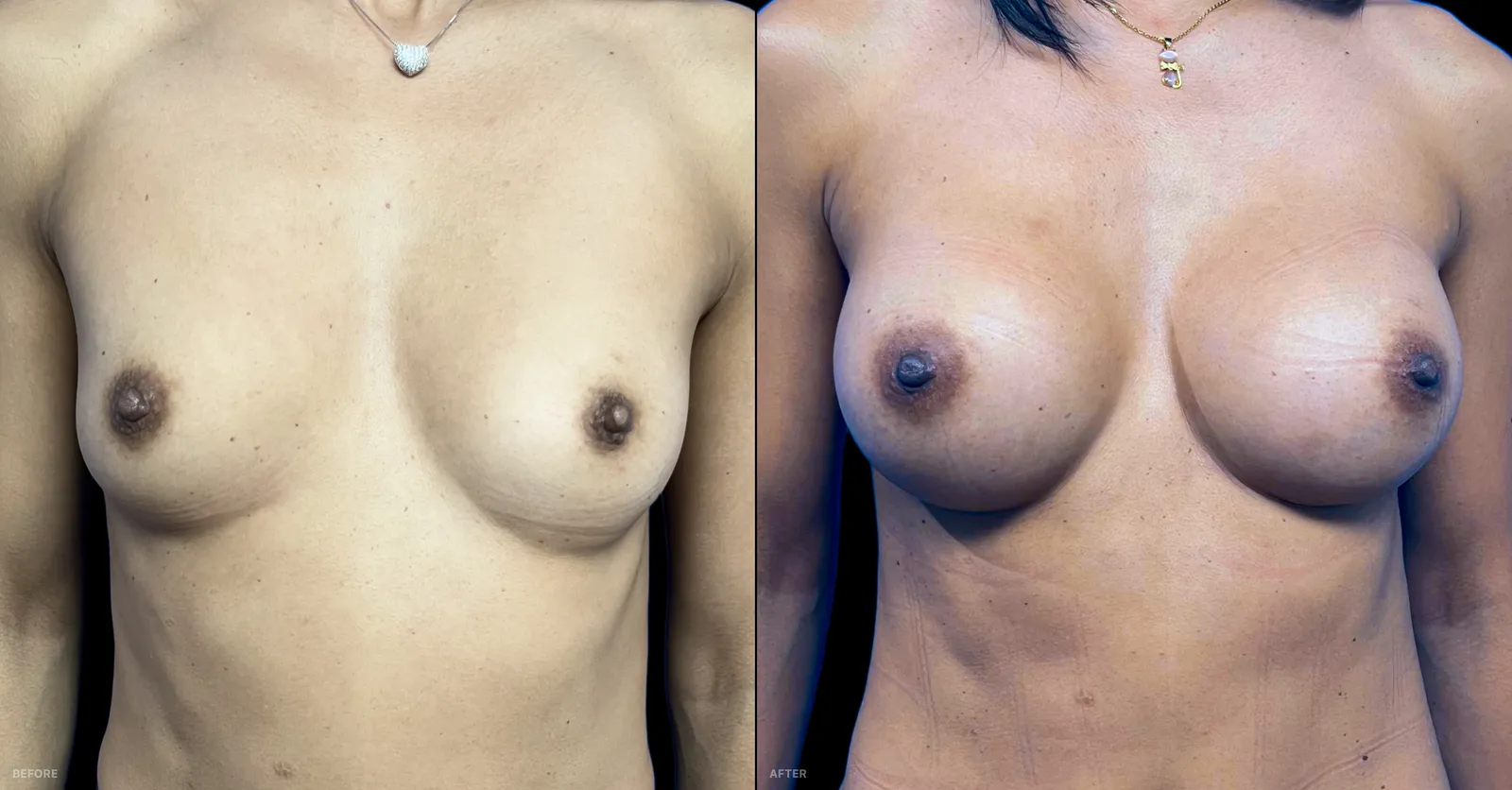 Antes y después